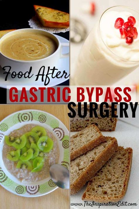 Here are some Food to Eat After Gastric Bypass Surgery Bypass Surgery Diet, Gastric Bypass Meal Plan, Rny Recipes, Gastric Bypass Diet, Bariatric Recipes Sleeve, Gastric Bypass Recipes, Vsg Recipes, Wls Recipes, Bariatric Friendly Recipes