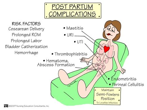 Heart Nursing, Newborn Nursing, Postpartum Nursing, Child Nursing, Labor Delivery Nursing, Independent Day, Nursing Mnemonics, Ob Nursing, Nursing Schools