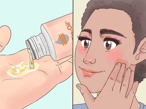 How to Use Bio Oil: 14 Steps (with Pictures) - wikiHow Bio Oil For Face, Bio Oil Uses, Essential Oils For Pregnancy, Natural Bug Repellent, Acne Overnight, Fly Repellant, Bio Oil, Dark Circles Under Eyes, Bug Repellent