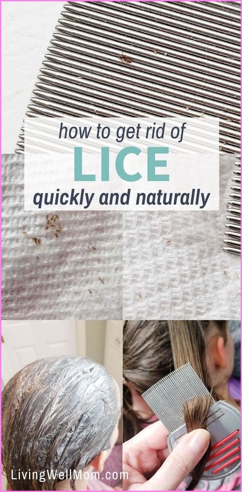 Your beauty is a gift; cherish and nurture it #BeautyTips #skincare #haircare #BeautySecrets Lice Spray For Furniture, Natural Lice Remedies, Essential Oils For Lice, Lice Prevention Spray, Lice Spray, How To Treat Lice, Lice Remedies, Hair Lice, Lice Prevention