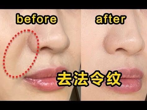 How To Smile Naturally For Photos, How To Smile, How To Smile For Photos, Japanese Face Massage, Japanese Lines, Beginner Dance, Face Massage Anti Aging, Face Massage Techniques, Facial Massage Routine