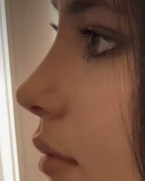 Upturned Nose, Rhinoplasty Nose Jobs, Job Inspiration, Straight Nose, Pretty Nose, Perfect Nose, Button Nose, Beauty Goals, Nose Job