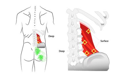 How to Relieve Back Strain Pain by Releasing QL Muscle Ql Muscle, Quadratus Lumborum, Rib Pain, First Rib, Back Strain, Increase Blood Flow, The Therapist, Muscle Strain, Trigger Points