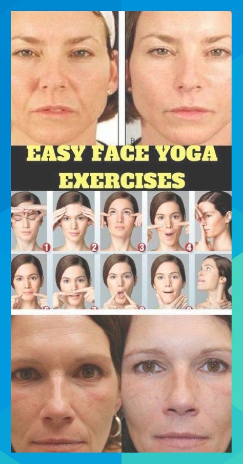 Firstly, it’s hailed as a non-invasive alternative to Botox and surgery, but how exactly will doing facial exercises help banish fine lines, sagging and wrinkles? #mireillemckenzie786 Acne On Nose, Motivasi Diet, Chin Exercises, Botox Alternative, Face Yoga Exercises, Neck Exercises, Facial Yoga, Face Exercises, Yoga Posen