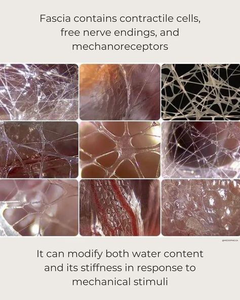 MYOFASCIAL CHAINS. We kinda got littlebit obsessed over myofascial chains, muscle-fascia relation, fascial therapy and myofascial release lately😅🙃! Why? Well... First. The results we obtain in clinic are outstanding. Long lasting. Impressive. Second. By working on the fascia, we release deep hidden trauma from the nervous system. Often leading to improvements in pain, health and function.... for good! Third. There are more and more studies going out supporting myofascial (chains and) ... Myofascial Release Massage, Fascia Release, Nervus Vagus, Gluteus Maximus, Craniosacral Therapy, Basic Anatomy And Physiology, Massage Business, Latissimus Dorsi, Chiropractic Wellness