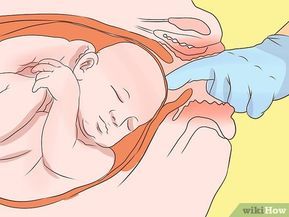 Inducing Labor At Home, Induce Labor At Home, Natural Ways To Induce Labor, Labor Inducing Exercises, Ways To Induce Labor, Labor At Home, Pregnancy Due Date, Contractions Labor, Weeks Of Pregnancy