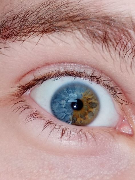 Mixed Eye Color, Unusual Eye Color, Central Hetrochormia Eyes, Two Colored Eyes, Multicolored Eyes, Pretty Eyes Color, All Eye Colors, Eye Color Chart, Blue Eye Color