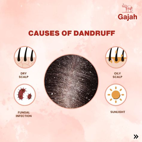 Struggling with Dandruff and Hair Loss? Gajah is Here to Help! Dandruff and hair loss are common hair concerns that many of us face at some point. These issues can be frustrating and even embarrassing, affecting not only the health of your hair but also your confidence. The good news? Gajah has got you covered! Whether you're struggling with dandruff, hair loss, or both, Gajah’s range of natural products is designed to nourish your scalp, strengthen your hair, and promote regrowth. Dandruff... Dandruff Hair, Hair Concerns, Oily Scalp, Fungal Infection, The Good News, Natural Products, Dandruff, Good News, The Good