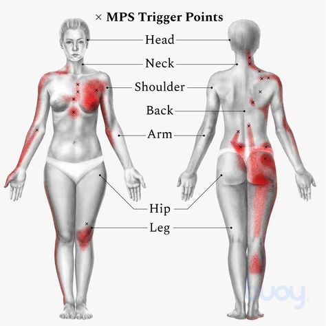 Myofascial Release Massage, Forward Head Posture Exercises, Myofascial Pain Syndrome, Knee Pain Remedy, Calf Cramps, Muscle Pain Relief, Muscles In Your Body, Myofascial Release, Knee Pain Relief