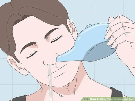 How to Clear Your Sinuses and Ears (with Pictures) - wikiHow Plugged Ears Remedy Sinus Infection, Sinus Flush, Ear Congestion Relief, Sinus Infection Relief, Relieve Ear Pressure, Ear Pressure Relief, Acute Sinusitis, Ear Congestion, Sinus Inflammation