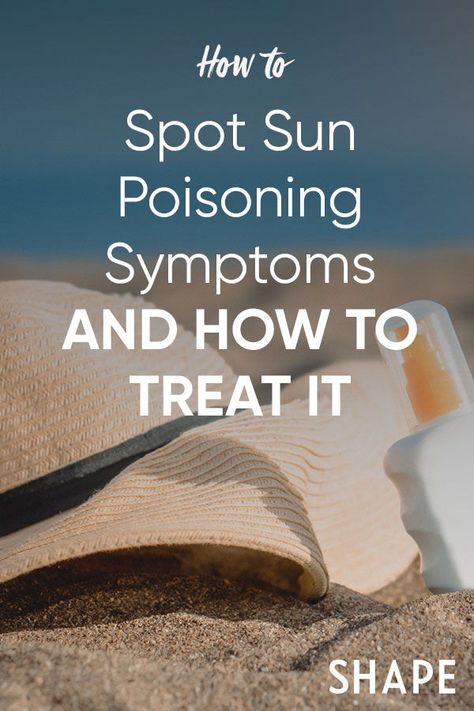 Top derms weigh in on what you need to know about sun poisoning, how to recognize the symptoms of sun poisoning, and how to treat it. #summer #sunsafety #heat #sunpoisoning Sun Allergy Rash, Sun Poisoning, Sun Sensitivity, Sun Rash Remedies, Heat Rash Remedy For Adults, Sun Poisoning Rash, Itchy Sunburn, Sun Blisters, Heat Rash Remedy