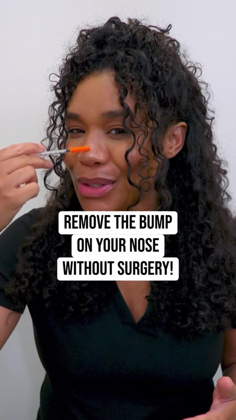 How To Get A Nose Lift, How To Naturally Get A Button Nose, How To Get Straight Nose, Bumped Nose, Smooth Nose, Button Nose Exercise, How To Contour Your Bulbous Nose, How To Get A Button Nose, Botox Nose