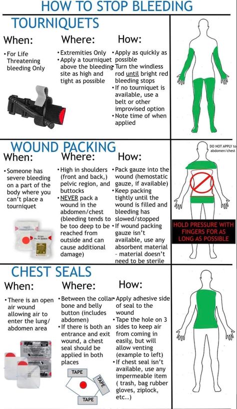 Survival Skills Emergency Preparedness, Self Defence Training, Survival Skills Life Hacks, Writing Prompts For Writers, Medical School Essentials, Survival Life Hacks, Survival Techniques, Prepper Survival, Survival Life