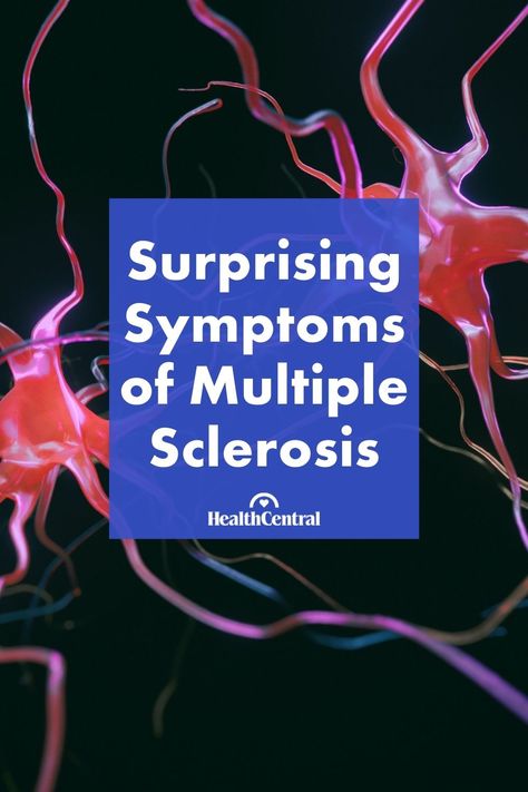 Ms Symptoms, Body Attack, Too Much Estrogen, Low Estrogen, Estrogen Dominance, Receding Gums, Medical Terms, Fitness Advice, Patient Experience