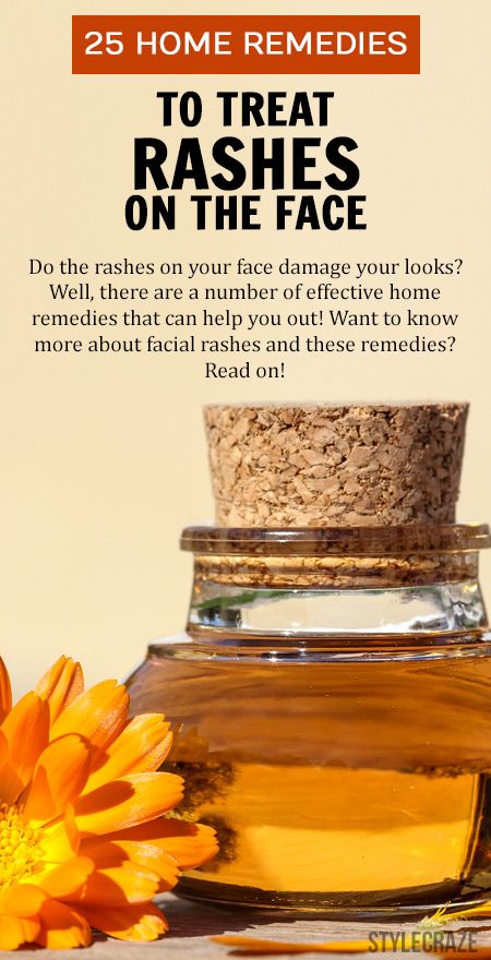 Do the rashes on your face damage your looks? ...  #SkinCare Face Rash Remedies, Skin Rash Remedies, Home Remedies For Rashes, Home Remedies For Face, Sagging Skin Remedies, Rash On Face, Rashes Remedies, Back Acne Remedies, Home Remedies For Skin