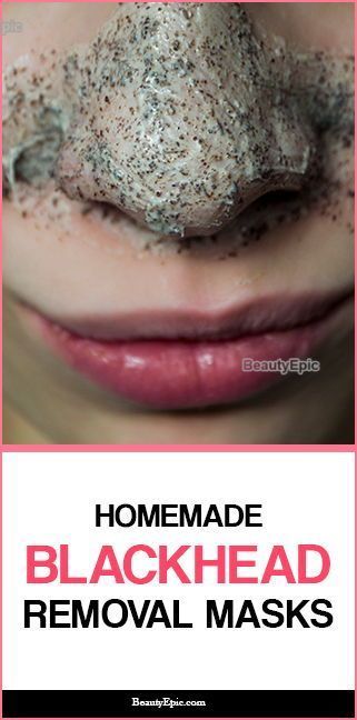 Blackhead Removal Mask, Black Head Removal, Blackhead Remover Diy, Face Mask For Blackheads, Black Head Remover Mask, Blackhead Mask, Cold Sores Remedies, Blackhead Removal, Natural Sleep Remedies