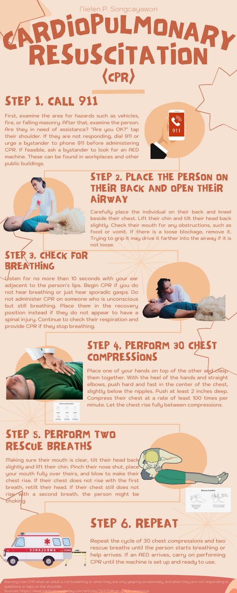 Step-by-step CPR process Cpr Notes, Cpr Steps, Cpr Business, Cpr Poster, Cpr Instructor, Bls Cpr, Small Business Shirt, Health And Safety Poster, Cardiopulmonary Resuscitation