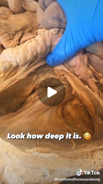 Dr. Tom Walters, DPT, OCS on Instagram: "💥𝐏𝐬𝐨𝐚𝐬 𝐀𝐧𝐚𝐭𝐨𝐦𝐲💥 —— 👉Can you really release the psoas muscle with massage techniques? Probably not. This video from @instituteofhumananatomy highlights just how deeply this muscle is located. - 🔎Psoas major is the deepest core muscle and the only muscle that attaches the trunk to the lower limb. It runs from the vertebrae and discs of the low back (T12-L5) down to the lesser trochanter on the inside of the femur. This unique configuration allows psoas to possess the dual role of spinal stabilizer and hip flexor. - 🧠If you are experiencing pain in the low back, sacroiliac joint region or hip, it is worth your time to determine whether or not addressing your hip flexors may help. This can be most easily accomplished by adding a bit of Back Massage Technique, Lower Back Massage Techniques, Psoas Stretch Release, Lower Limb Anatomy, Hip Muscles Anatomy, Psoas Muscle Pain, Anatomy Videos, Psoas Major, Knee Mobility