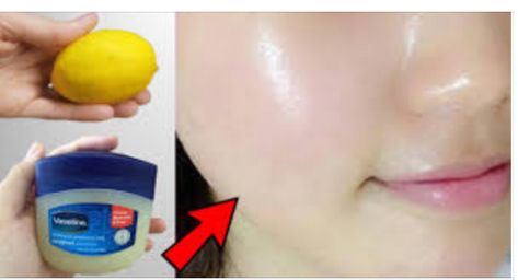 Unlock the Secret: Transform Your Beauty Routine with Vaseline and Lemon! Natural Wrinkle Remedies, My New Haircut, Lemon Uses, Wrinkle Remedies, Brightening Mask, Petroleum Jelly, Diy Remedies, Small Jars, New Haircuts