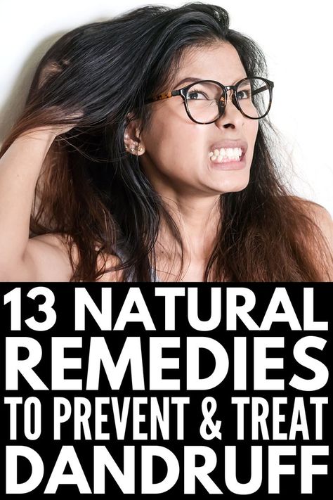 13 Prevention Tips and Home Remedies for Dandruff What Causes Dandruff, Dry Scalp Remedy, Natural Dandruff Remedy, Hair Mask For Dandruff, Dandruff Causes, Home Remedies For Dandruff, Dandruff Remedy, Getting Rid Of Dandruff, Hair Dandruff