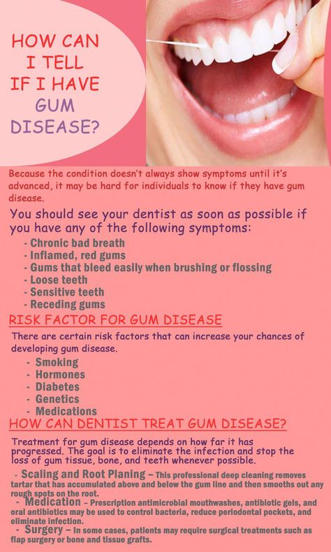 Gum disease is a dental condition that is the number one cause of adult tooth loss, and impacts overall health. Treating gum disease can be an involved process, depending on how advanced the condition has progressed. #gumdisease #oralcare #dental #dentalhygienist #healthyliving #Tarzana #california #PreventiveOralHealthCare Tarzana California, Chronic Bad Breath, Healthy Gums, Oral Care Routine, Gum Care, Receding Gums, Oral Health Care, Teeth Care, Dental Hygienist