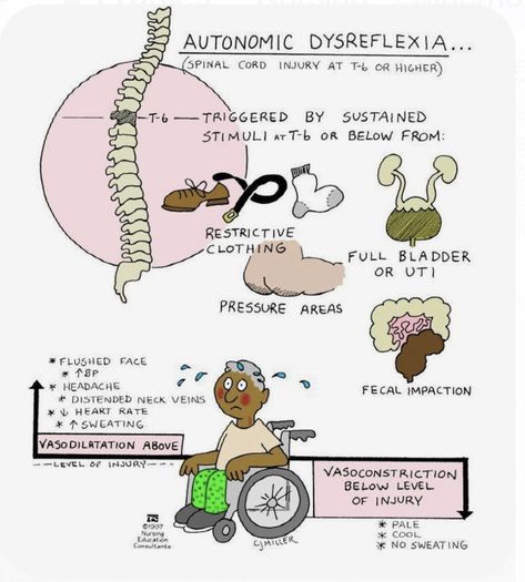 Autonomic Dysreflexia Nursing, Nurse Vocabulary, Autonomic Dysreflexia, Nursing Study Notes, Nursing Cheat Sheet, Nursing Cheat, Psychology Notes, Nursing Student Tips, Student Tips