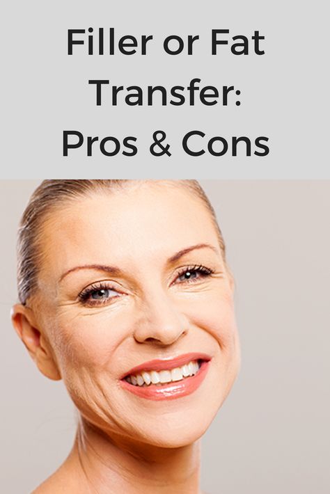 Fillers vs. Fat Transfer: Pros & Cons | For many years, facial rejuvenation was limited to skin resurfacing with lasers and peels, and various surgical soft tissue repositioning procedures. But now, with so many non-surgical injectable options available, it’s often difficult to decide which is right for you. Face Dermal, Cheek Fat, Sagging Cheeks, Sagging Face, Under Eye Fillers, Face Fillers, Cheek Fillers, Fat Grafting, Facial Fillers