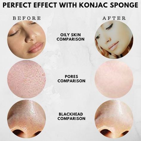 #konjac #konjacsponge #healthyskin #skinhealth #naturalbeauty #facewashing #skincleaning  #skincare #veganskincare #beauty #makeup Face Sponge, Dead Skin Removal, Deep Exfoliation, Body Sponge, Natural Sponge, Facial Sponges, Konjac Sponge, Skin Care Tutorial, Silky Skin