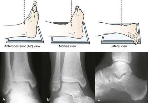 Diagnostic Radiography, Radiography Student, Radiology Schools, Medical Radiography, Radiologic Technology, Medical Assistant Student, Radiology Student, Radiology Technician, Computed Tomography