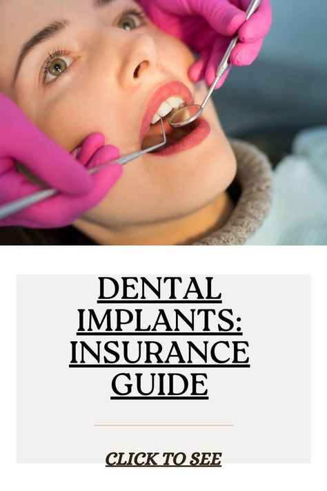 Wondering if your insurance will pay for dental implants? Learn which plans offer coverage, what to expect, and alternative financing options. #DentalInsurance #DentalImplants #OralHealth #MoneyMatters #InsuranceTips #SmartSpending Dental Procedures, Jaw Bone, Dental Insurance, Money Matters, Dental Implants, Oral Health, Insurance, Life Hacks, Wonder