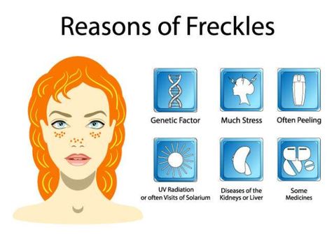 How To Remove Freckles From Face, Remove Freckles From Face, How To Get Freckles Naturally, How To Get Freckles, Getting Rid Of Freckles, Freckle Remover, Post Inflammatory Hyperpigmentation, Essential Oil Mixes, Banana Peel