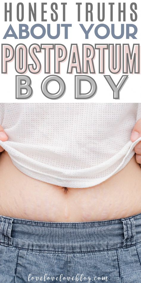 As a new mom, you may not be prepared for the hair loss and engorgement that comes after having a baby, so here's a peek into those postpartum body changes. Belly Binding Postpartum, Belly Binding, Postpartum Hair, Modern Baby Names, Third Pregnancy, Pregnant Baby, Monthly Baby Photos, Advice For New Moms, Post Baby Body