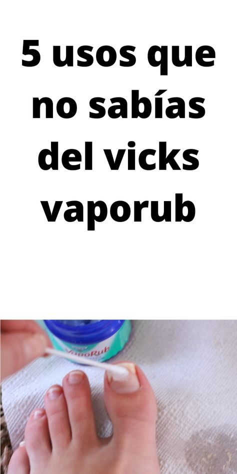 5 usos que no sabías del vicks vaporub Vic Vaporub, Diy Natural Detergent, Vicks Vaporub Uses, Constant Headaches, Uses For Vicks, Improve Nutrition, Liver Diet, Holistic Diet, Magnesium Benefits