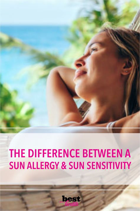 Sun Allergy Remedies, Sun Allergy Rash, Swelling Remedies, Summer Allergies, Sun Sensitivity, Allergy Rash, Sun Allergy, Spring Skin, Allergy Season