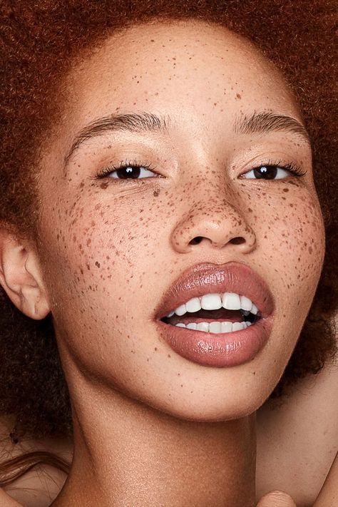 Freckles Photoshoot, Freckle Makeup, Black Girls With Freckles, Women With Freckles, Freckles Makeup, Photoshoot Editorial, Beautiful Freckles, German Beauty, Freckles Girl