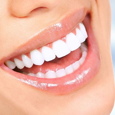 WHAT ARE THE INGREDIENTS OF CLEANER SMILE? Pretty Teeth, Veneers Teeth, Teeth Whitening Diy, Beautiful Teeth, Perfect Teeth, 얼굴 그리기, Sikat Gigi, Smile Teeth, Best Teeth Whitening