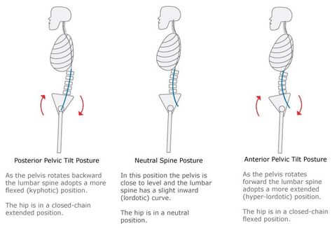 anterior pelvic tilt and posterior pelvic tilt Pelvic Tilt Exercise, Gym 101, Posterior Pelvic Tilt, Lumbar Lordosis, Anterior Pelvic Tilt, Neck And Shoulder Exercises, Psoas Release, Pelvic Girdle, Neck Problems