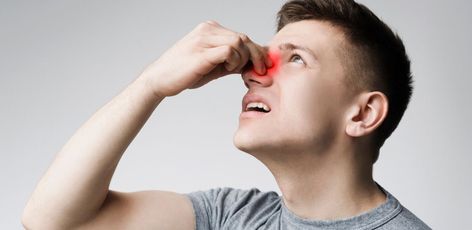 What are Nasal Polyps: How to Tell if You Have Nasal Polyps Stop Nose Bleeds, Nasal Polyps, Sinus Inflammation, Chronic Sinusitis, Headache Causes, Sinus Pain, Allergic Rhinitis, Mri Scan, Blood Sugar Diet