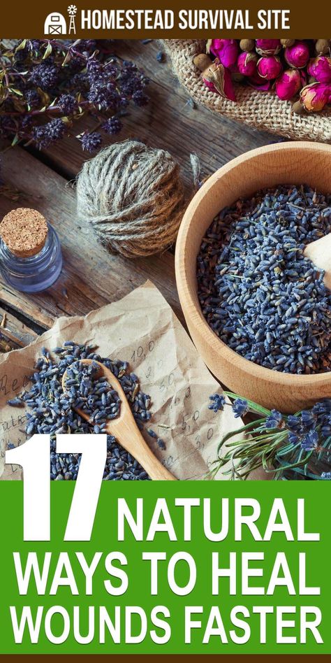 There are many natural remedies to speed up the healing process and prevent infection. We’ll take a look at some natural ways to help wounds heal faster. #homesteadsurvivalsite #firstaid #naturalremedies #homehealthcare #homeremedy Heal Wounds Faster, Home Remedies For Spiders, Home Remedies For Warts, Ways To Heal, The Healing Process, Cold Sores Remedies, Natural Healing Remedies, Natural Sleep Remedies, Natural Cold Remedies