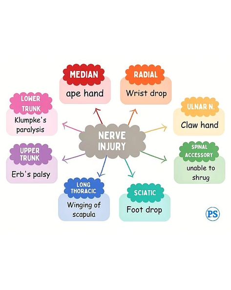 Nerve Injury 🚨 . #nerve #nervedamage #nervepain #education #instaeducation #science #medical #medicalscrubs #neuroscience #pns #cns #median #radial #ulnar #upper #lower #physiotherapy #physiodiaries #physiotherapist #physiospirit Ulnar Nerve Injury, Nerve Injury, Nurse Study, Ulnar Nerve, Median Nerve, Nurse Study Notes, Lower Limb, Nerve Damage, Bts Pics