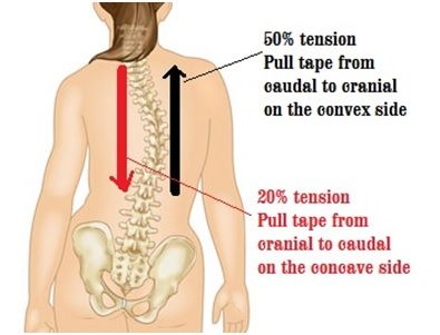 A Scoliosis Tape Punkty Spustowe, Massage Ideas, Spinal Health, Flexibility Exercises, Aerial Yoga Poses, Guided Relaxation, Kinesio Taping, Home Exercise Program, Psoas Muscle