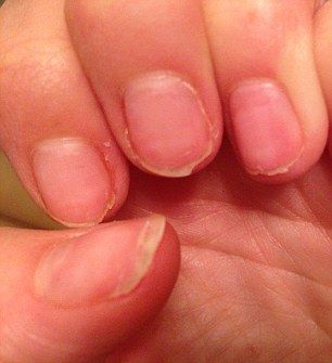 Manicure and the damages it can cause. Nails After Acrylics, Beauty Hacks Nails, Spring Acrylic Nails, Damaged Nails, Nails 2020, Beauty Products Drugstore, Get Nails, Strong Nails, Summer Nails Colors