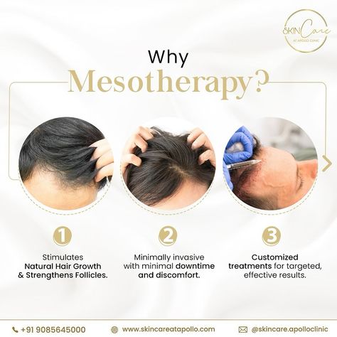 💁‍♀️Unlock the secret to lush locks with Mesotherapy at Apollo! We understand how your heart breaks each time you look at your falling hair 💔. And how it’s extremely frustrating to try every failed method with hope. However, try Mesotherapy once and feel the difference 😍. From stimulating hair growth to strengthening follicles, every session brings you closer to your dream mane 🙆 ✅. Book your Mesotherapy appointment now 📱 +91- 9085645000 #MesotherapyMiracle #HairRevival #ApolloSkincare... How To Book Appointments, Mesotherapy Hair, Falling Hair, Stimulating Hair Growth, Prp Therapy, Hair Content, Clinic Interior, Heart Breaks, V Hair