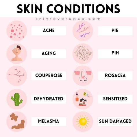 𝙽𝚊𝚝𝚊𝚕𝚒𝚎 | 𝙱.𝚂., 𝚒𝚗 𝙱𝚒𝚘𝚕𝚘𝚐𝚢 on Instagram: “Here are common #SkinConditions that any skin type may experience in any combination! Don’t forget to save this chart for quick reference…” Skin Types Chart, Healthy Alternatives, Skin Conditions, Skin Type, Biology, Skin Types, Body Care, Instagram Profile, Conditioner