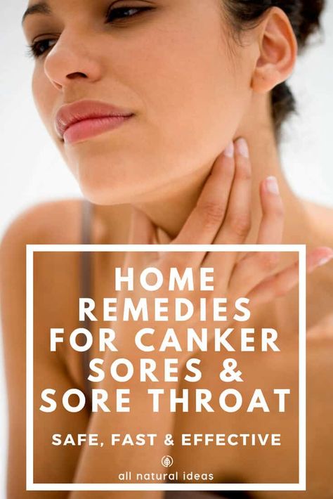 Do you have a nagging, unsightly sore on the inside of your mouth that’s making it difficult to enjoy your food or even talk? If so, check out these home remedies for canker sores and sore throat. #cankersore #sorethroat #naturalremedy | allnaturalideas.com via @allnaturalideas Canker Sore Remedy, Health Resolutions, Fever Blister, Canker Sore, Cold Sore, Sore Throat, Health Info, Healing Process, Healthy Tips