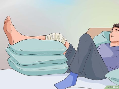 How to Treat a Knee Sprain: 13 Steps (with Pictures) - wikiHow Knee Sprain Recovery, Dislocated Knee, Sprained Knee, Knee Sprain, Knee Taping, Knee Ligament Injury, Rash Causes, Hairline Fracture, Knee Ligaments