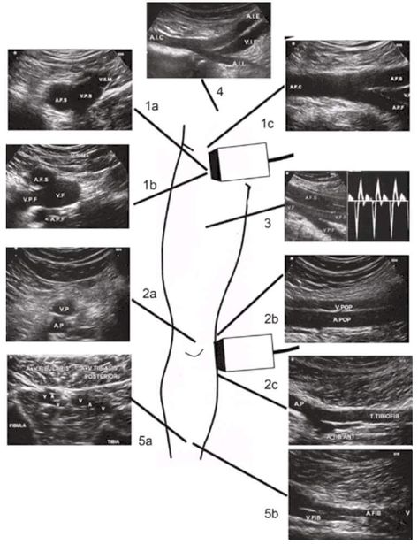 Vascular Sonography, Ultrasound Technician School, Diagnostic Medical Sonography Student, Ultrasound School, Ultrasound Physics, Cardiac Sonography, Vascular Ultrasound, Sonography Student, Ultrasound Sonography