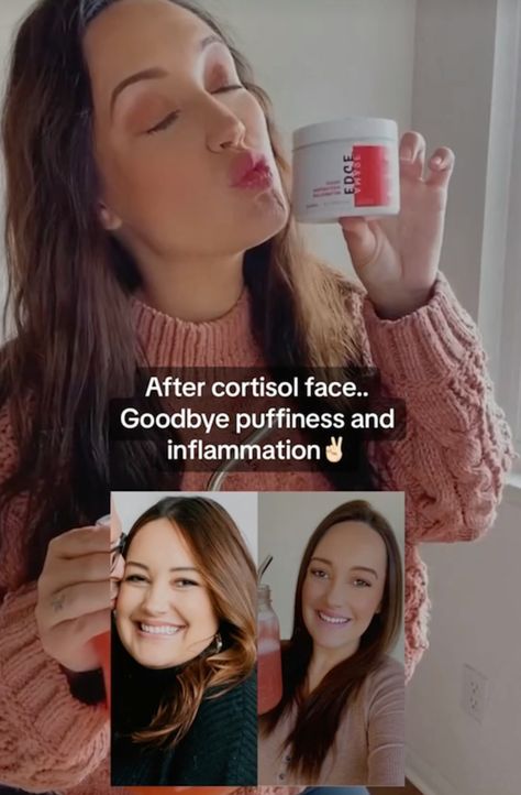 What Is Cortisol Face? A Side Effect Caused By Stress Moon Face Cortisol, Cortisol Face Before And After, How To Get Rid Of Cortisol Face, Cortisol Face, Tiktok People, Facial Puffiness, Lower Cortisol Levels, Fluid Retention, Cortisol Levels