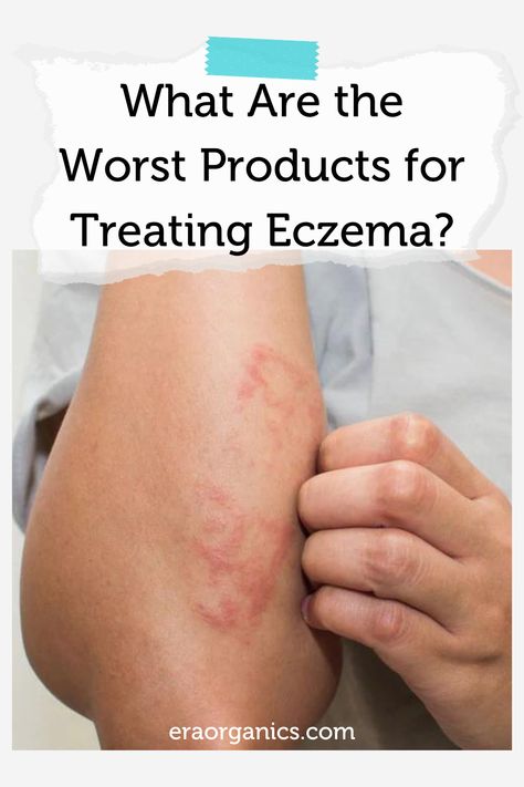 Those who suffer from eczema are all too familiar with eczema symptoms that they are trying to get to the doctor in search of prescription eczema creams to bring relief. However, what if we told you that certain eczema creams are making your condition worse? Here is what you can do instead. #organicskincare #naturalskincare #eczema Benefits Of Coffee, Body Wrap, Skin Mask, Natural Home Remedies, Natural Treatments, Tree Oil, Skin Cream, Tea Tree Oil, Natural Home