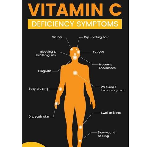 Vitamin C advantages and disadvantages Vitamin C Deficiency, Vitamin C Deficiency Symptoms, Swollen Gum, Scaly Skin, Wound Healing, Immune System, Vitamin C, Kids Art Projects, Gum